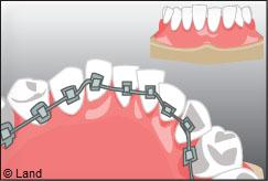Orthodontie