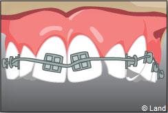 Orthodontie